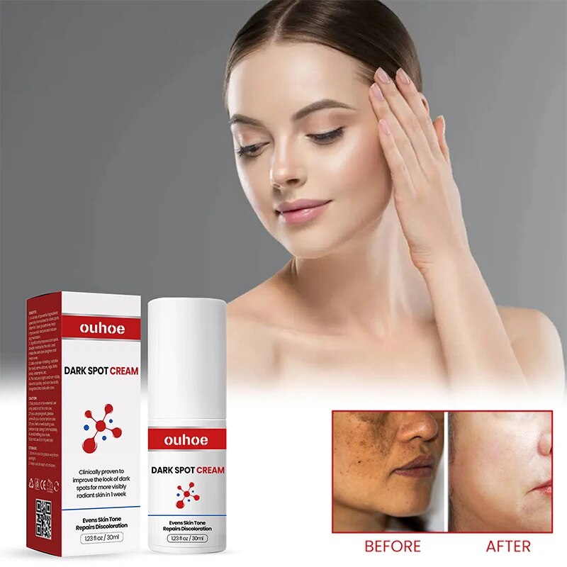 OUHOE DARK SPOT CREAM